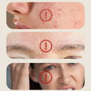 Máscara de LED Flexível 4 em 1 Rejuvenescimento e Anti-Acne